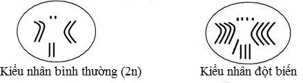 Từ sơ đồ kiểu nhân sau. Hãy cho biết dạng đột biến số lượng nhiễm sắc thể đã xảy ra?      	 (ảnh 1)